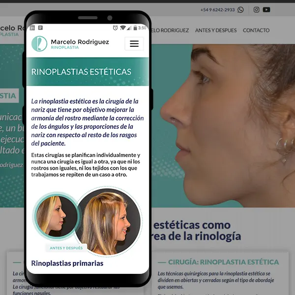 drrodriguezrinoplastia.com.ar